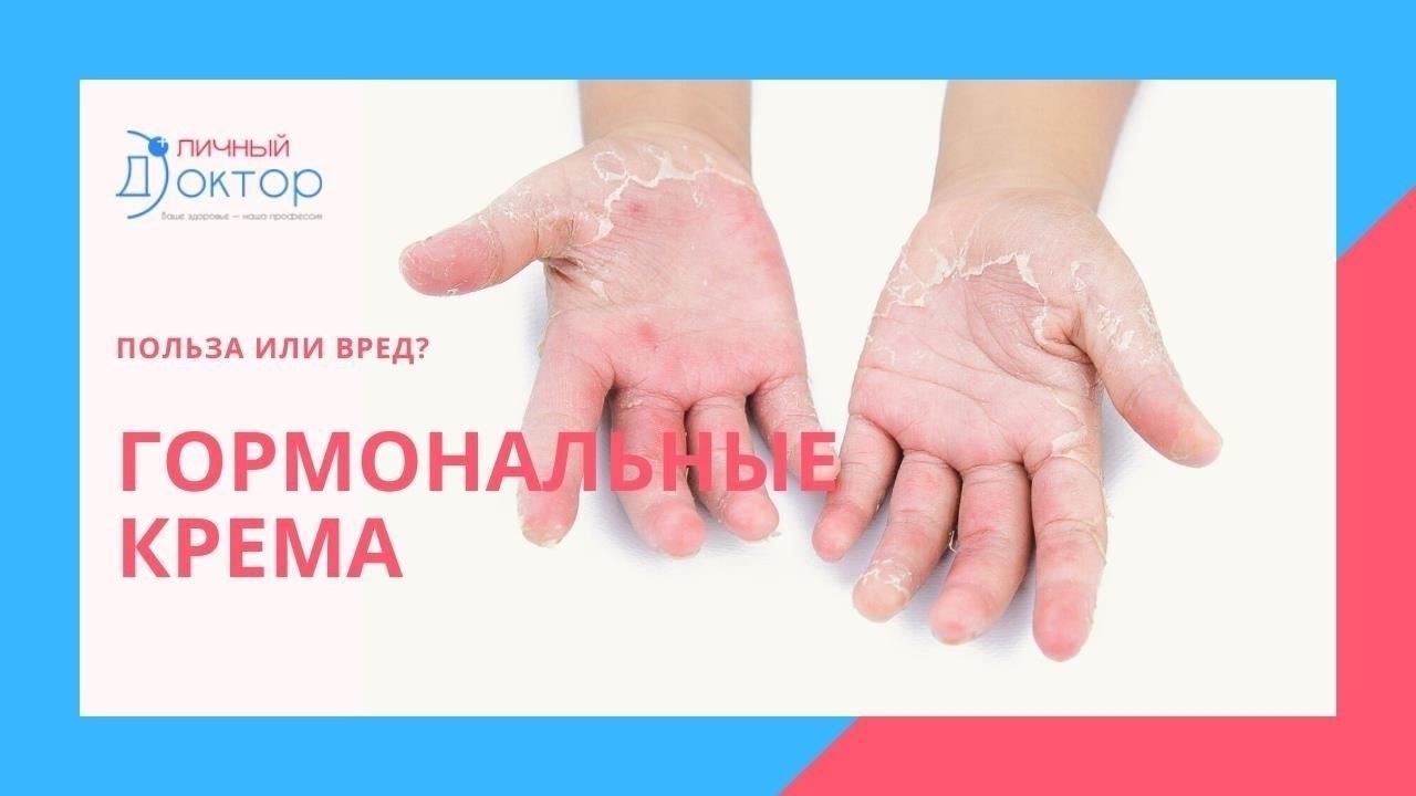 Что такое гормональные кремы?